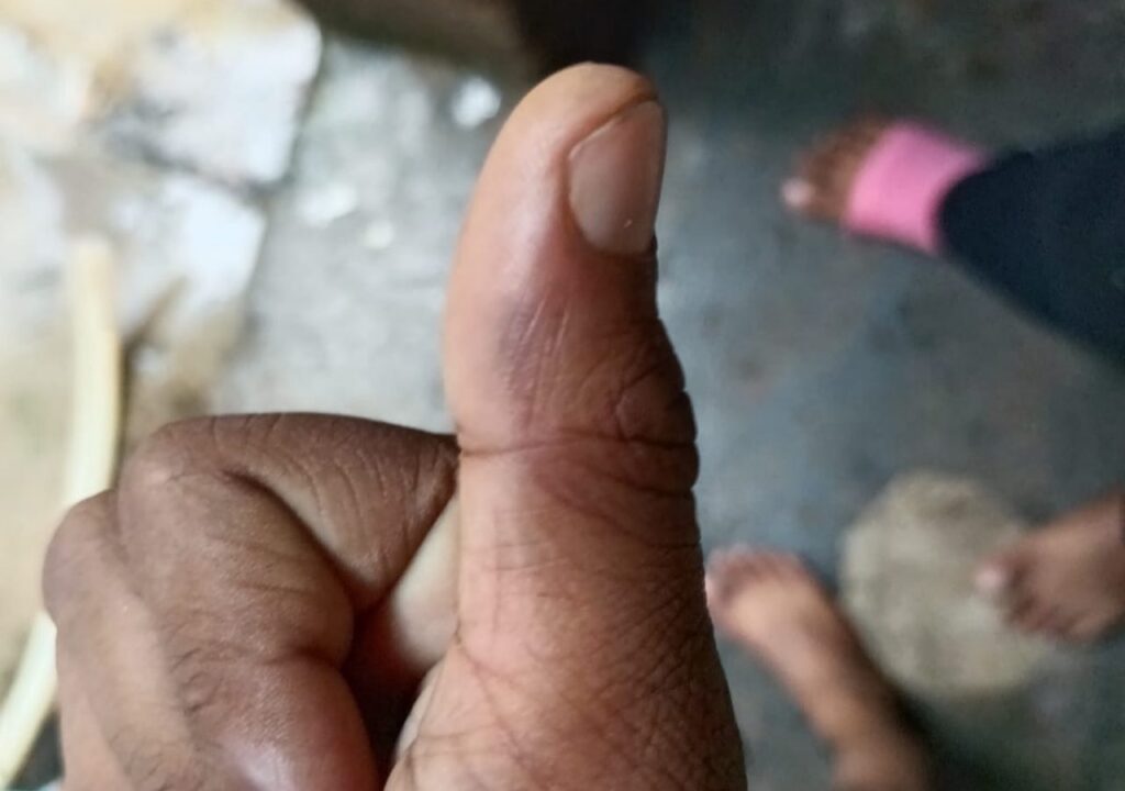 परिजनों द्वारा साझा की गई बच्चे की चोट वाली तस्वीर 
