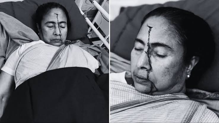 Mamata Banerjee Head Injury